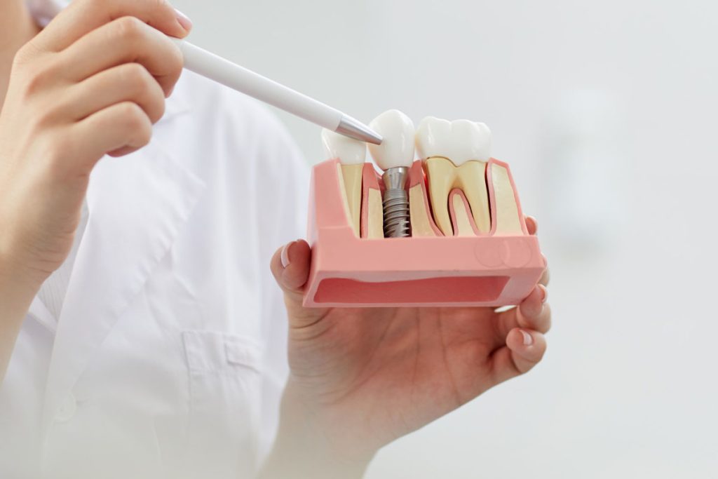 Dental Implants in New Brighton