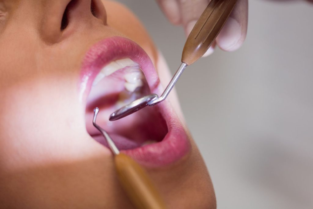 Periodontal Gum Care in New Brighton