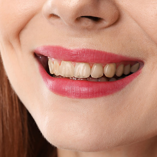 Who we are - Before slide