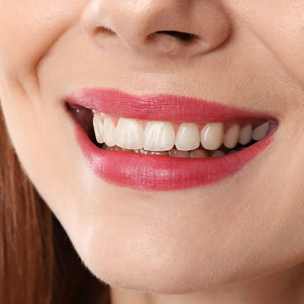 Who we are - after slide