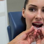 How Long Does Invisalign Take to Straighten Teeth