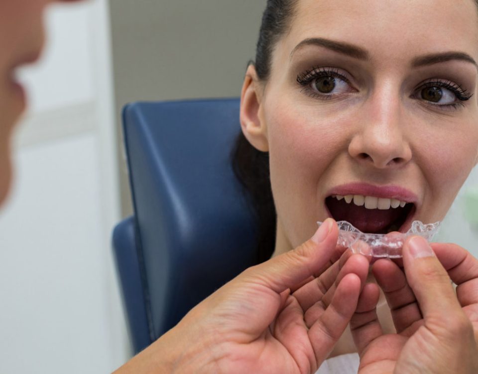 How Long Does Invisalign Take to Straighten Teeth