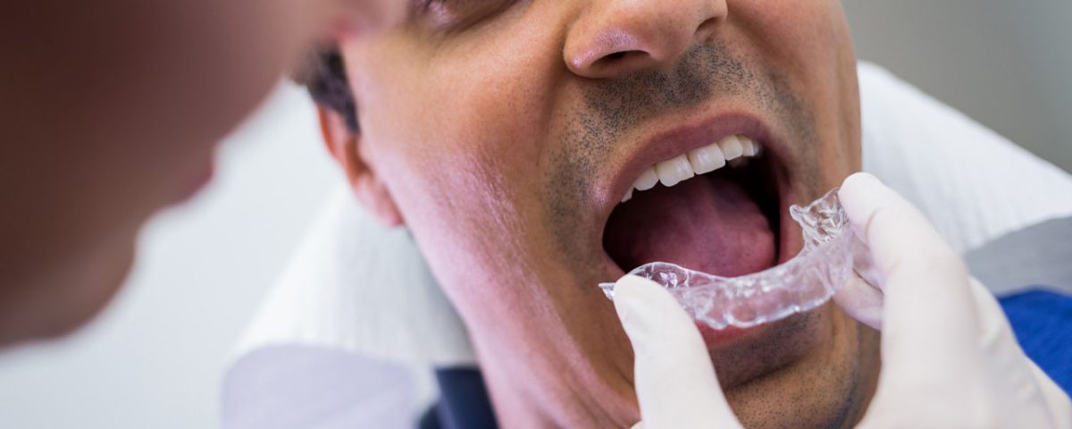 What is a Gold Invisalign Provider