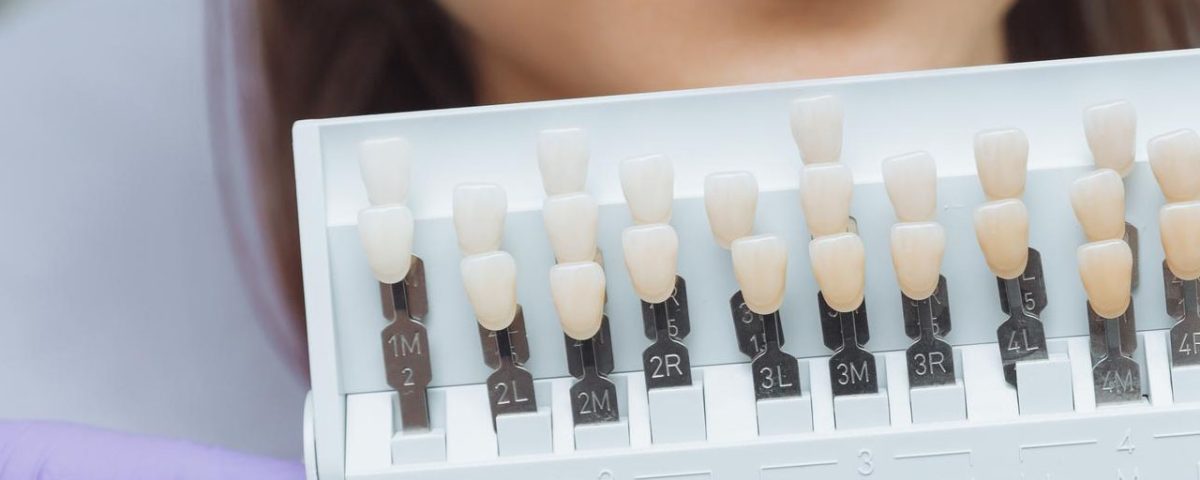 Composite Veneers vs. Porcelain Veneers Cost and Differences