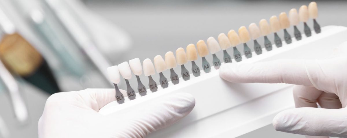 Do Porcelain Veneers Stain