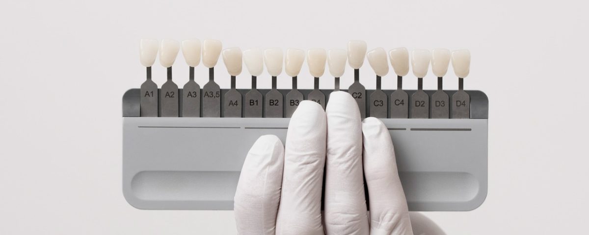 Can You Whiten Your Teeth if You Have Composite Bonding