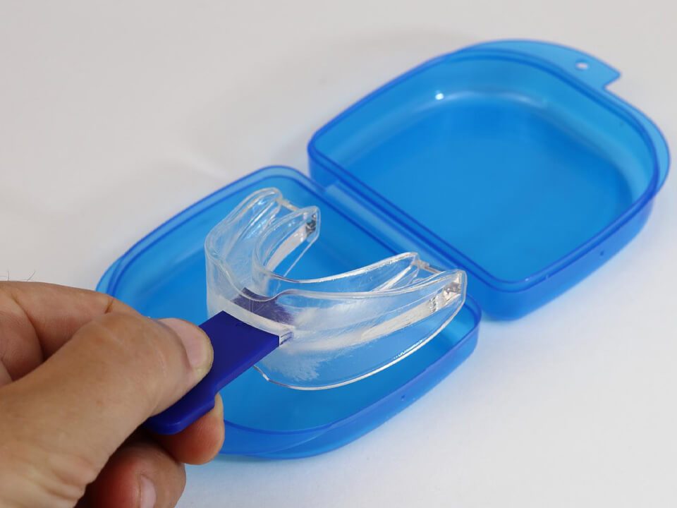 6 Easy Ways to Clean Mouthguards
