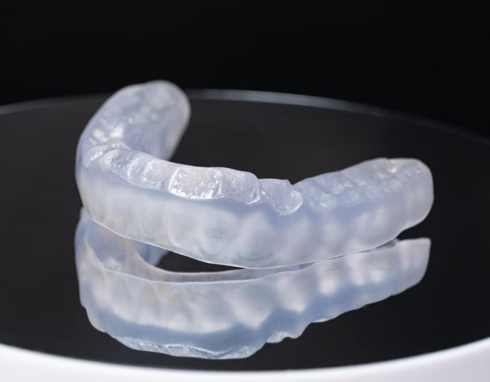 How to Fit a Mouthguard