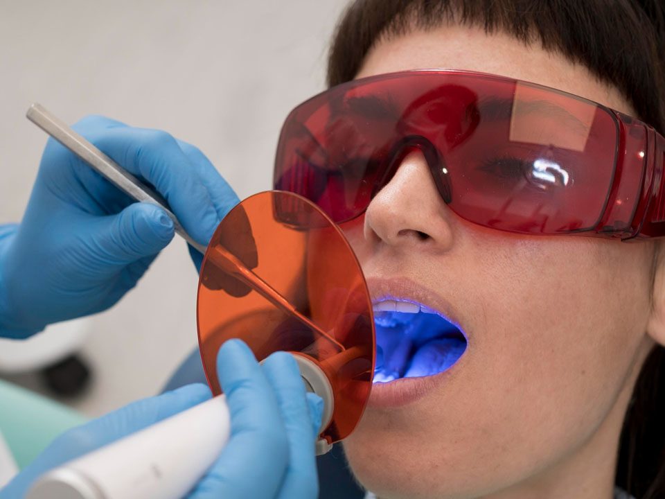 Laser Treatment for Periodontal Disease