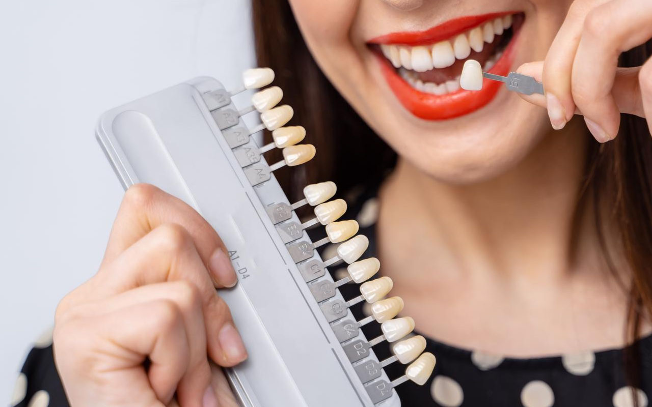 The Pros and Cons of Dental Veneers