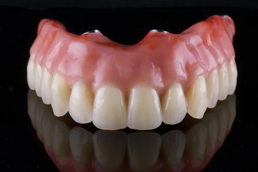 All On 4 Dental Implants New Brighton, MN - Services