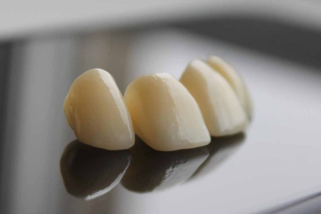 Dental Crown and Bridge Near Me in New Brighton, Minnesota