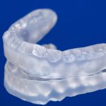 Night Guards for Teeth Grinding in New Brighton