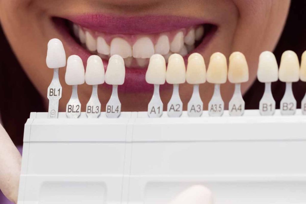 Porcelain Veneers Near Me in New Brighton, Minnesota