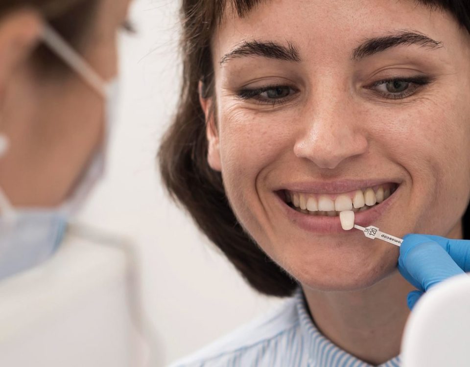 How Long Does Composite Bonding Last?